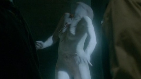 Nicole O'Neill in Penny Dreadful (2014-2016) Breasts Prosthetic Bald Breasts 767768