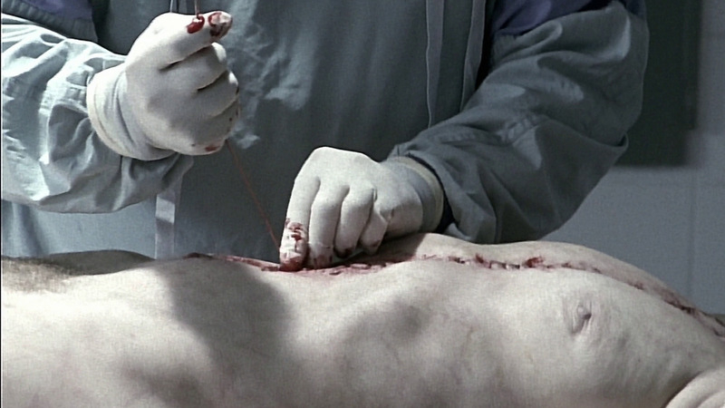 NA from Spiral Naked. Breasts, Bush, autopsy, cadaver. 803279