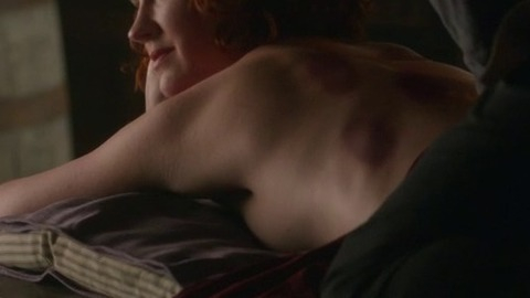 Hottest Frankie Drake Scenes. Sexy, SFW, cupping therapy. 822399