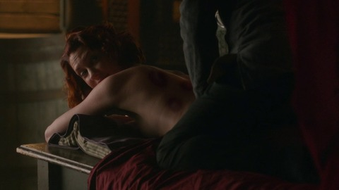 Sexiest Frankie Drake Scenes. Sexy, SFW, cupping therapy. 822400