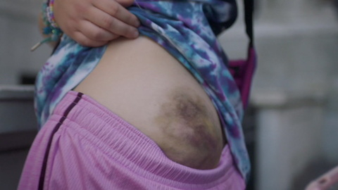 Betty's Sexiest Scenes with Nina Moran. Sexy, bruised butt, close up. 907434