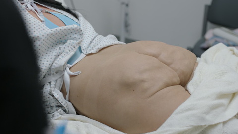 Megan Barkley Naked as Chanel Sutton. Butt, Prosthetic, butt injections, hospital. 1008033