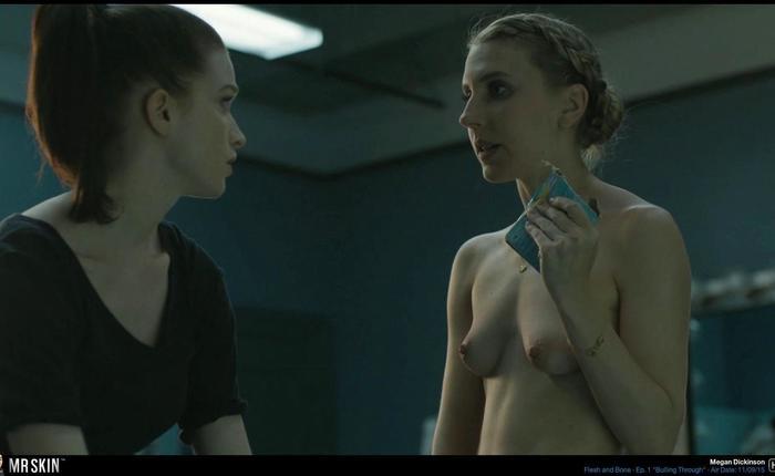 TV Nudity Report: Amazon Pilots, Fargo, Flesh and Bone, The Affair, The Knick, & Casual