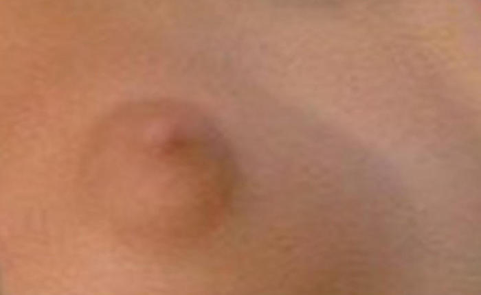 Guess That Celebrity Nipple 10.3.2017 