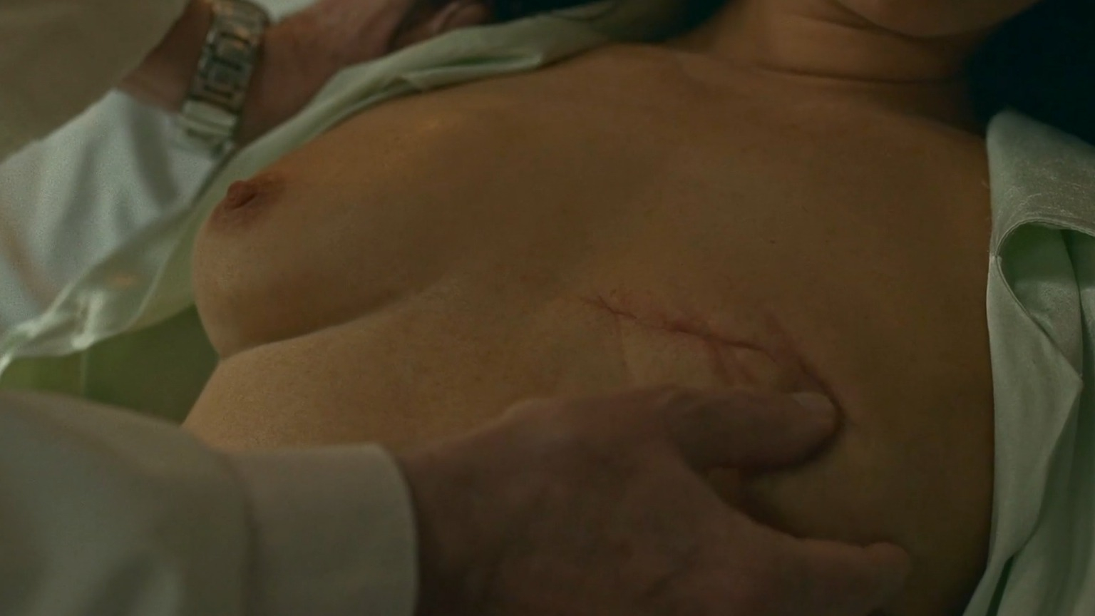 Nudes of Conchita from Saben aquell. Prosthetic, Right Breast, breasts, left breast. 347544