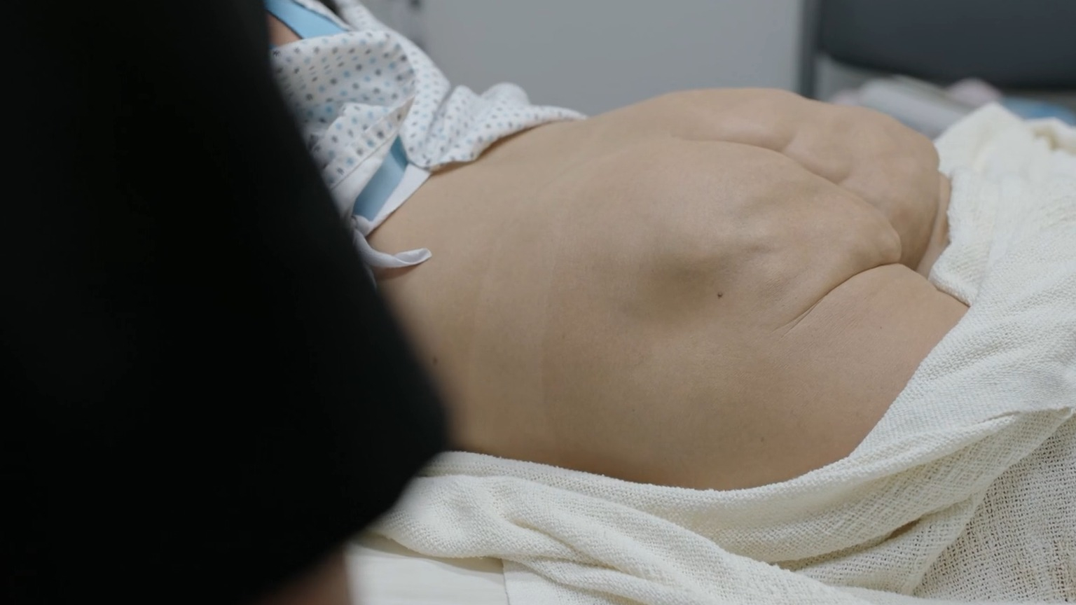 Megan Barkley in The Pitt (2025) Butt Prosthetic Butt Prosthetic 352287