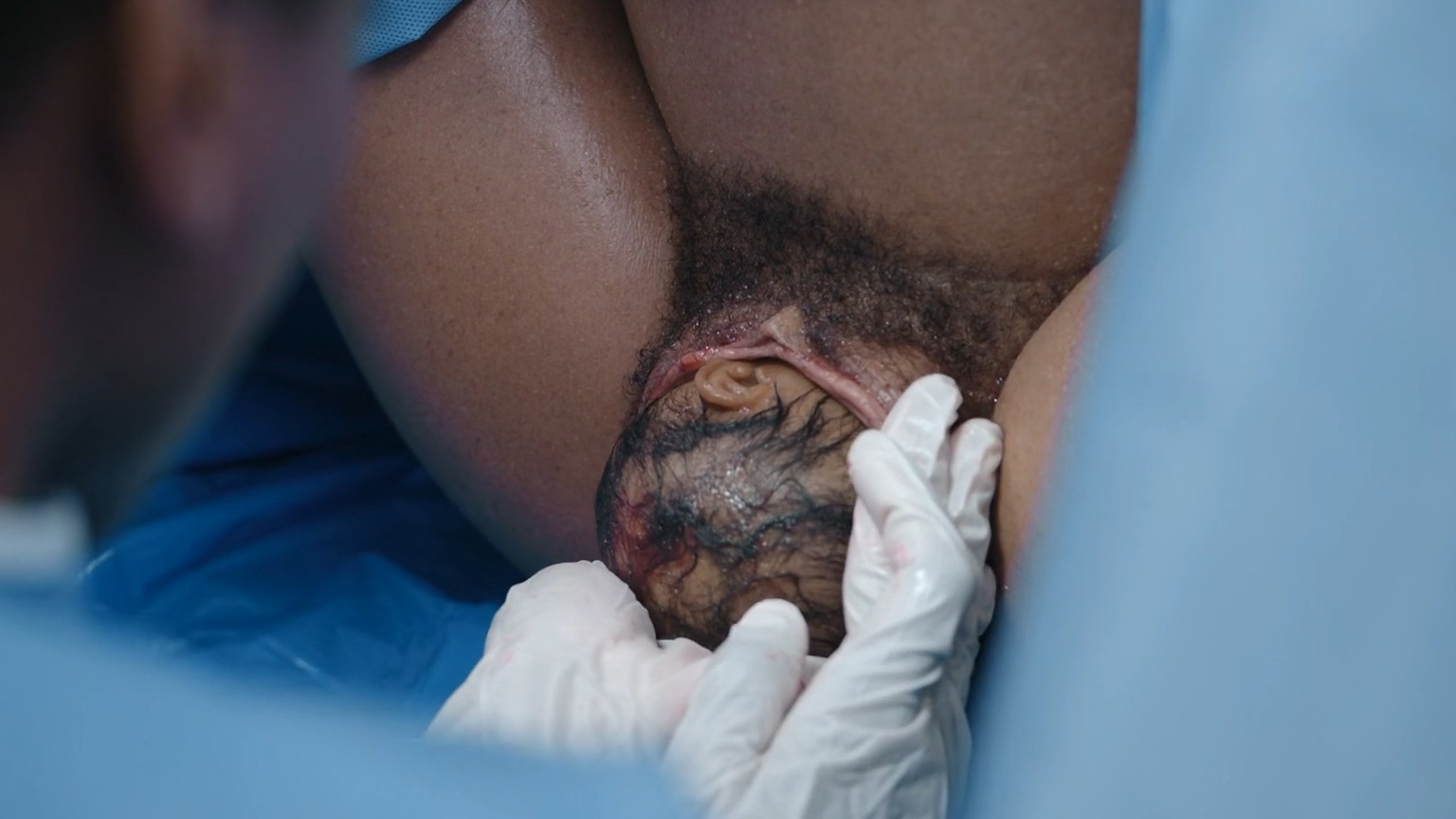 Enuka Okuma in The Pitt (2025) Bush Prosthetic Bush Butt 352652