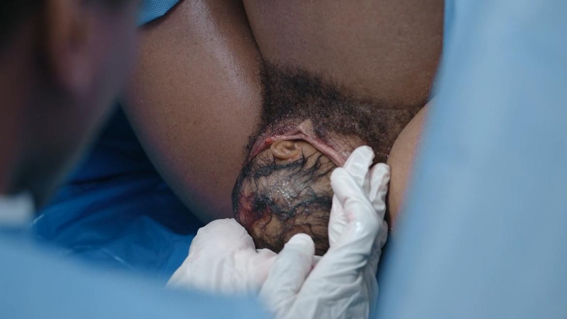 Enuka Okuma in The Pitt (2025) Bush Prosthetic Bush Butt 352652